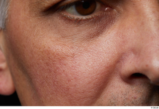 HD Face Skin Reuben Panjaitan cheek eye face skin pores…